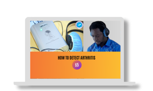 HOW TO DETECT ARTHRITIS