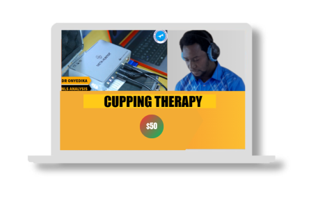 CUPPING THERAPY