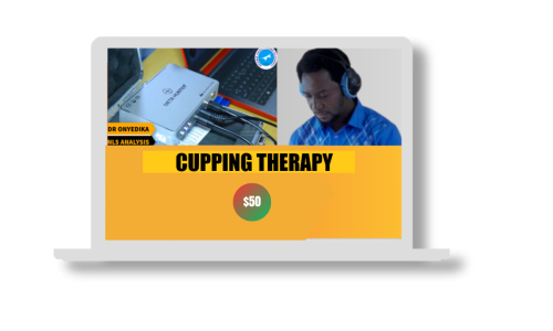 CUPPING THERAPY